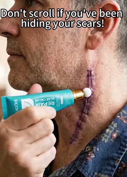 Medical Silicone Scar Removal Gel - For New & Old Scars