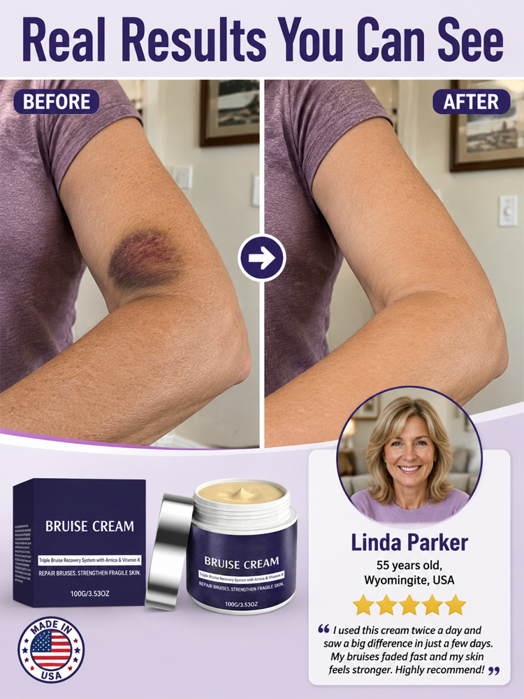 🩹 Dermatologist Recommended Bruise Recovery Cream – Triple Repair System with Arnica & Vitamin K Fades Dark Bruises in 7 Days – 50% OFF + 30-Day Risk-Free Trial, Full Refund & 10x Quality Guarantee