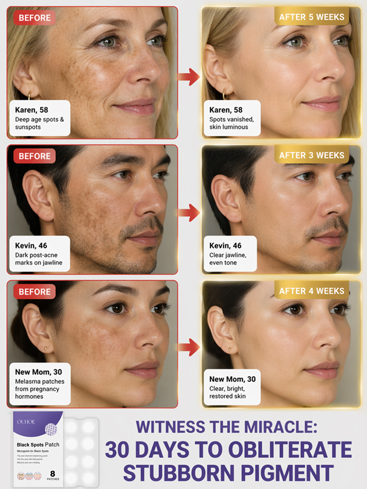 Facial Dark Spot Treatment Patches