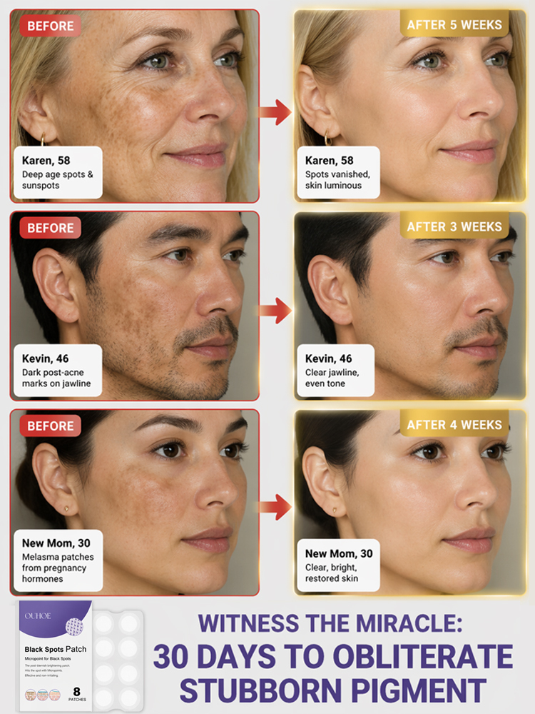 Facial Dark Spot Treatment Patches