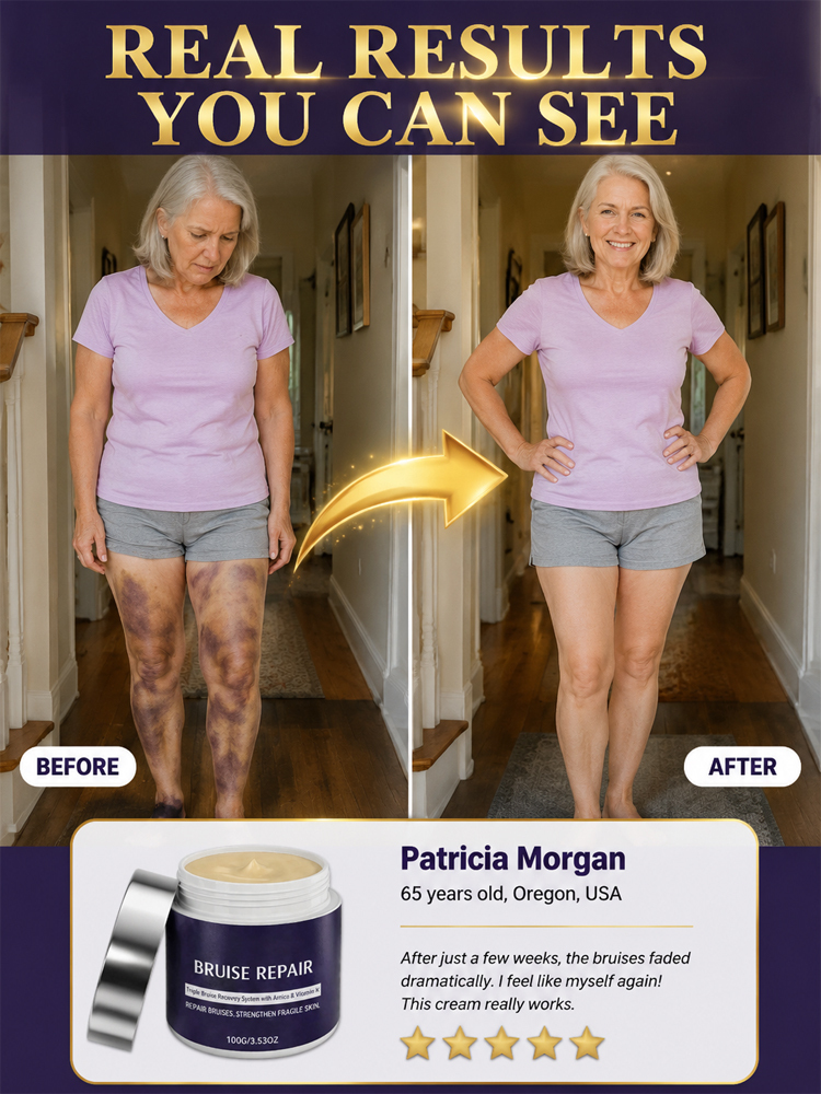 🩹 Dermatologist Recommended Bruise Recovery Cream – Triple Repair System with Arnica & Vitamin K Fades Dark Bruises in 7 Days – 50% OFF + 30-Day Risk-Free Trial, Full Refund & 10x Quality Guarantee