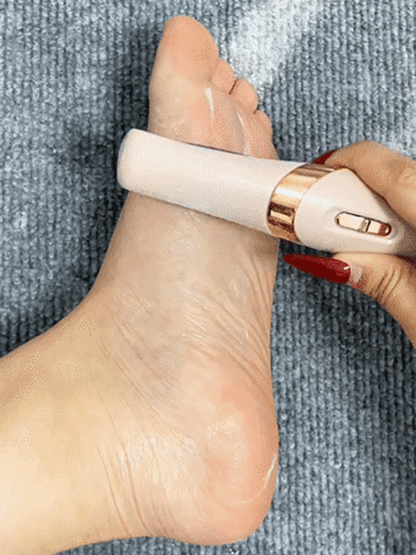 [Cumulative Sales 3 Million+] Electric Foot Grinder