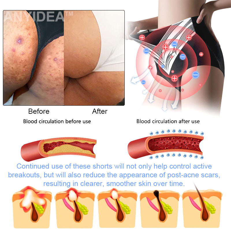 Medical Grade Titanium Fiber Self-heating Tourmaline Shaping Shorts