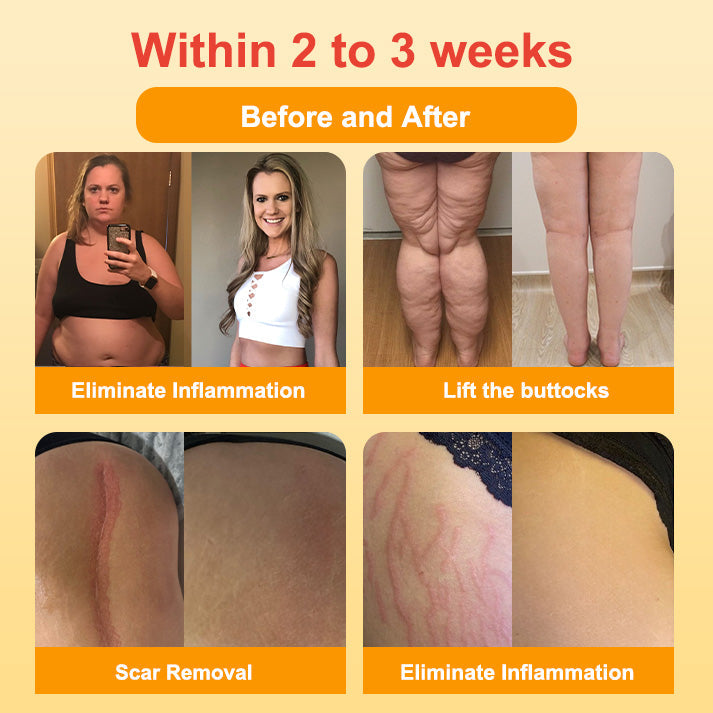 Medical Grade Titanium Fiber Self-heating Tourmaline Shaping Shorts