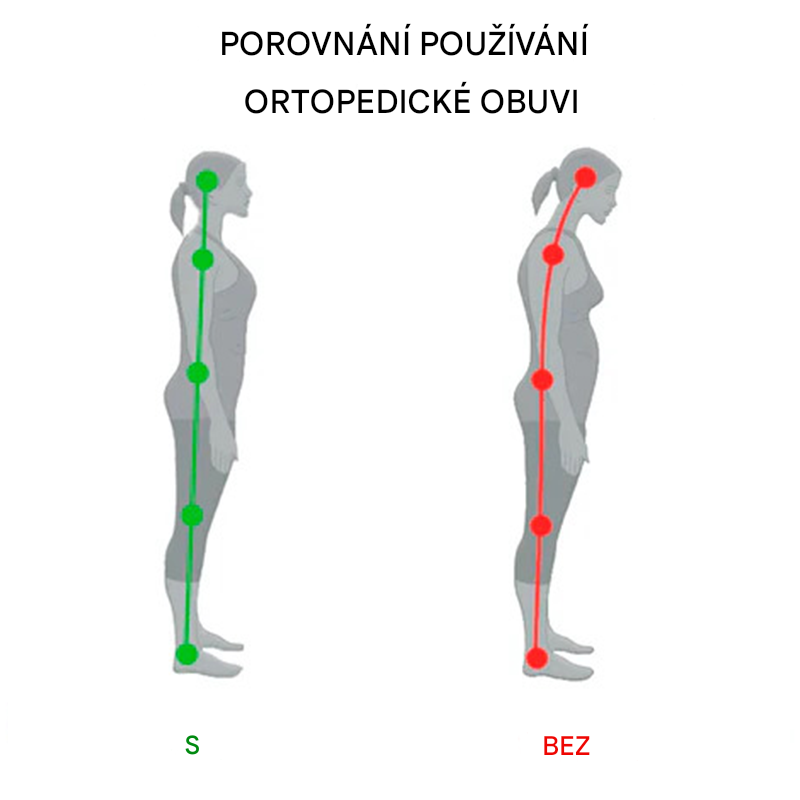 (🔥Dnes sleva 50 % – vezměte si to!) Prémiová stylová ortopedická obuv 👞 – Ergonomický design pro úlevu od bolesti