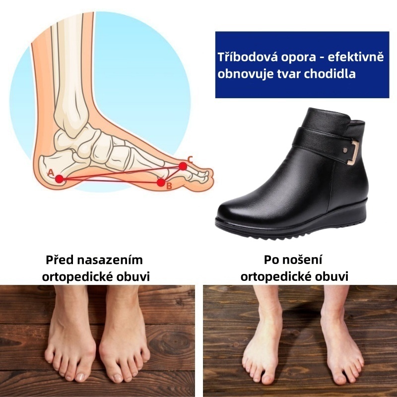 Sennery® - Ergonomická, nepromokavá, kožená ortopedická obuv pro úlevu od bolesti - Nová zimní kolekce