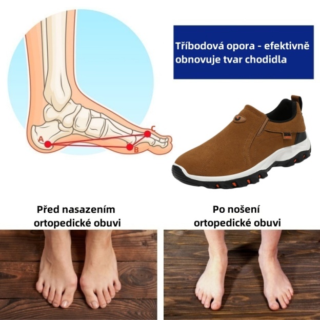 Sennery® – Ergonomicky navržená lékařská ortopedická obuv, která ulevuje od bolesti zad, kloubů a nohou.