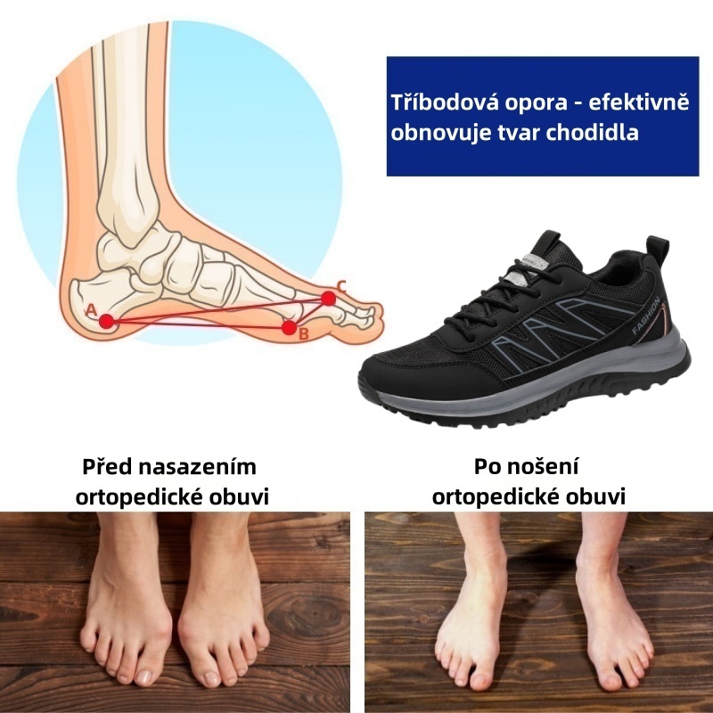 Sennery® – Ergonomicky navržená lékařská ortopedická obuv, která ulevuje od bolesti zad, kloubů a nohou.