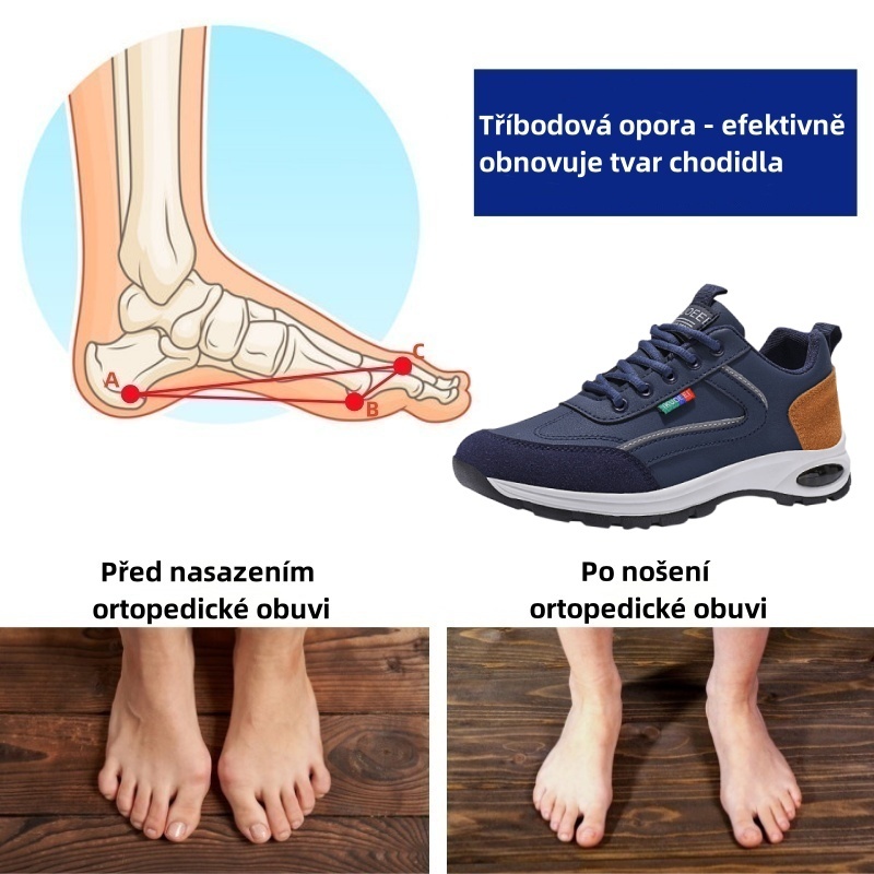 Sennery® – Ergonomicky navržená lékařská ortopedická obuv, která ulevuje od bolesti zad, kloubů a nohou.