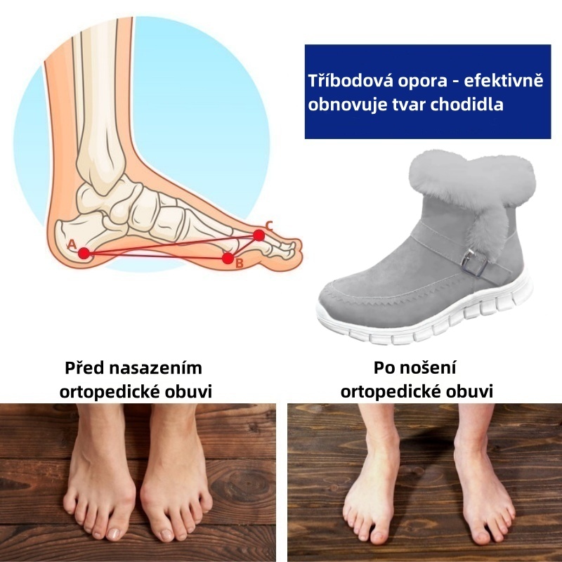 Sennery® - Ergonomicky tvarovaná zimní ortopedická obuv pro úlevu od bolesti nohou, kolen a zad - Dámské