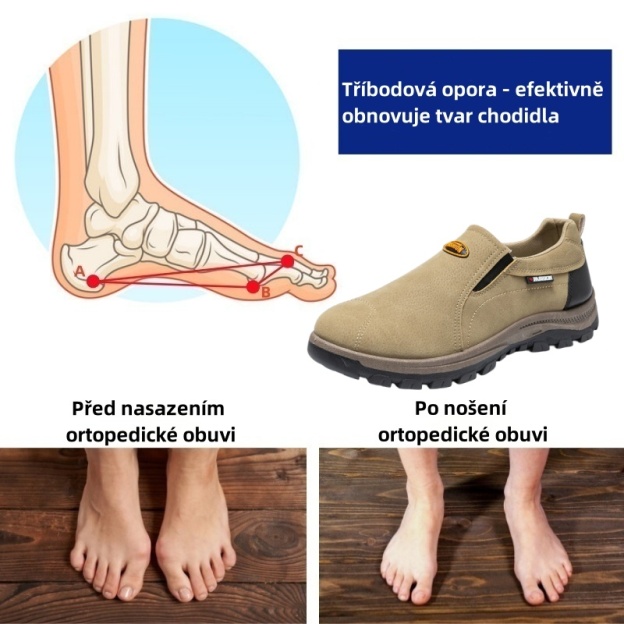 Sennery® – Ergonomicky navržená lékařská ortopedická obuv, která ulevuje od bolesti zad, kloubů a nohou.