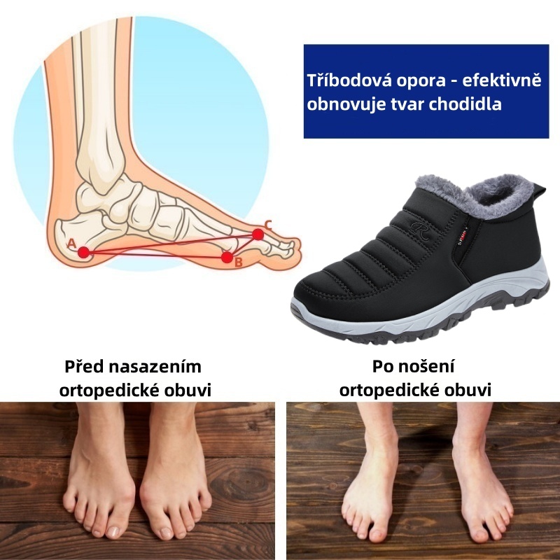 Sennery® - Ergonomická zimní ortopedická obuv pro bolesti nohou, kolen a zad - Unisex