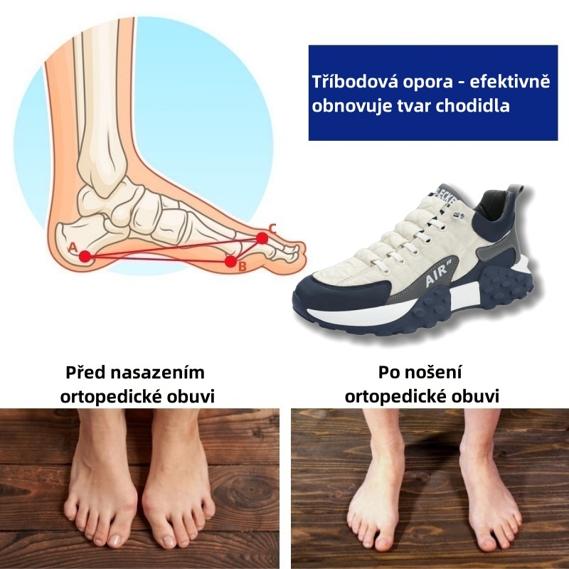 Ortopedická obuv Sennery® | Ergonomicky navržená pro úlevu od bolesti zad, kloubů a nohou a poskytuje výjimečné pohodlí (AIR).