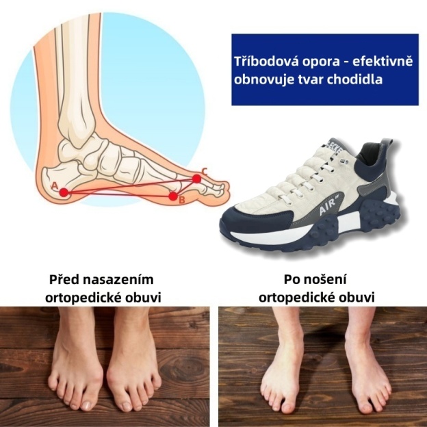 Ortopedická obuv Sennery® | Ergonomicky navržená pro úlevu od bolesti zad, kloubů a nohou a poskytuje výjimečné pohodlí (AIR).