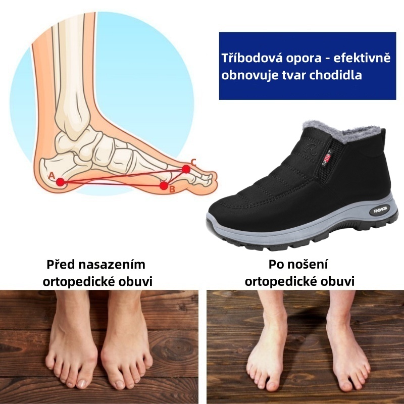 Sennery® - Ergonomická zimní ortopedická obuv pro bolesti nohou, kolen a zad - Unisex