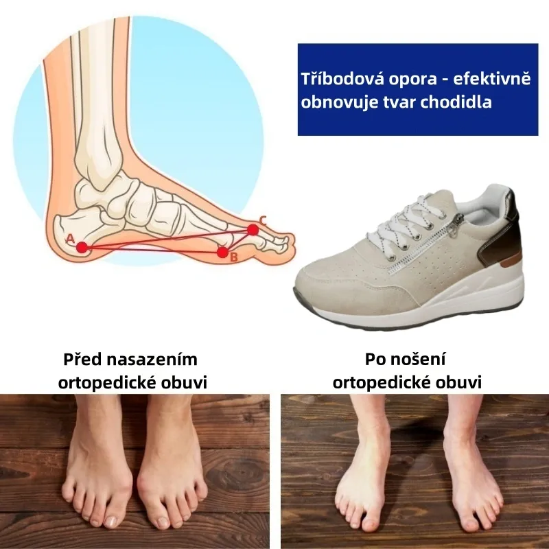 Sennery® – Ergonomicky navržená lékařská ortopedická obuv, která ulevuje od bolesti zad, kloubů a nohou.