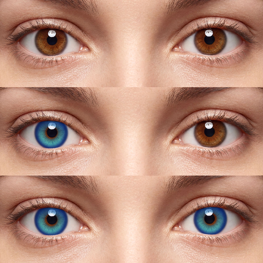 Lainis Blue - 1 Year, 2 lenses