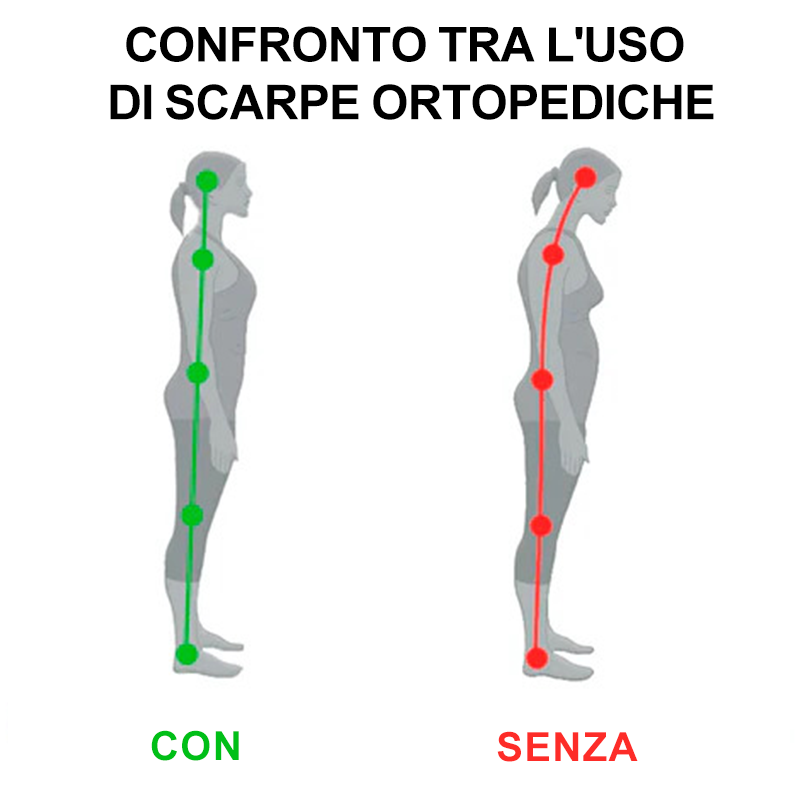 (🔥50% di sconto oggi - prendilo!) Scarpe ortopediche premium ed eleganti 👞 - Design ergonomico per alleviare il dolore