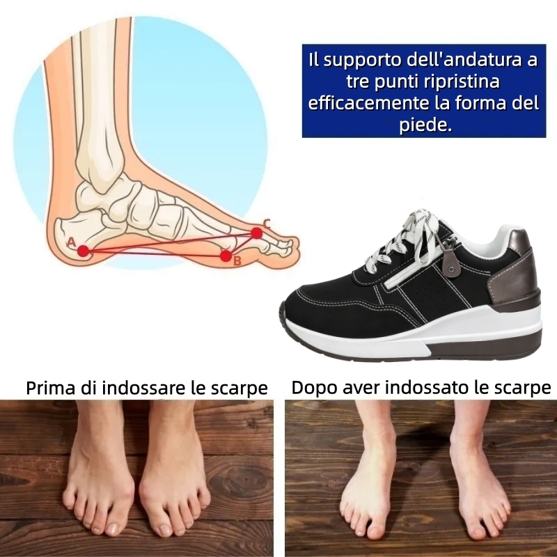 【⏰Ultimo giorno, 70% di sconto! Non perdete l'occasione!】Scarpe ortopediche ergonomiche con assorbimento degli urti, ✅️scarpe ortopediche salutari progettate specificamente per le donne europee.