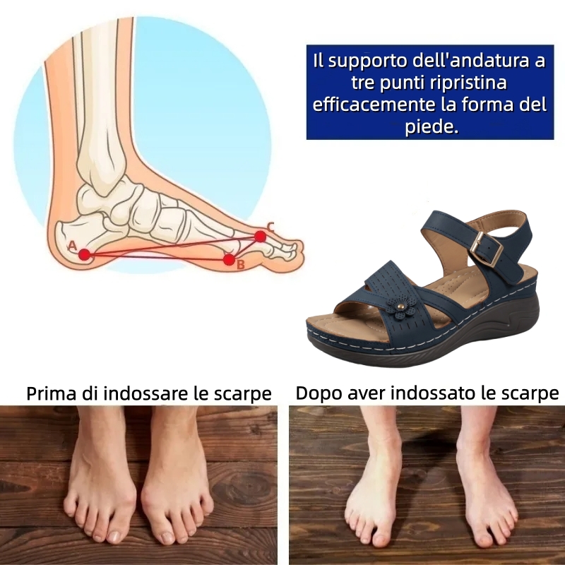【⏰Ultimo giorno, 70% di sconto! Non perdete l'occasione!】Sandali ortopedici dal design ergonomico con assorbimento degli urti, ✅️scarpe ortopediche salutari progettate specificamente per le donne europee.