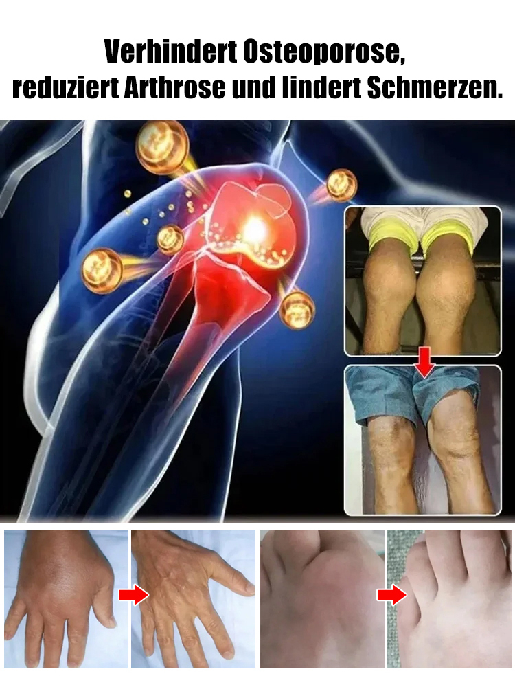 【100% Anwachsgarantie】 4J XXL Regina Süßkirschbaum | Kräftige 2-jährige Setzlinge | Ernte bereits im ersten Jahr | Ideal für Balkon und Garten | Winterhart bis -20°C 🍒