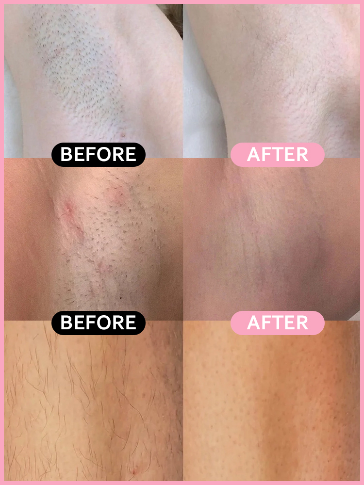 ✨ Experience Baby-Smooth Skin with the All-New 2-in-1 Painless Bikini Trimmer, Perfect for Any Hair Challenge, Boosting Your Confidence! 💃