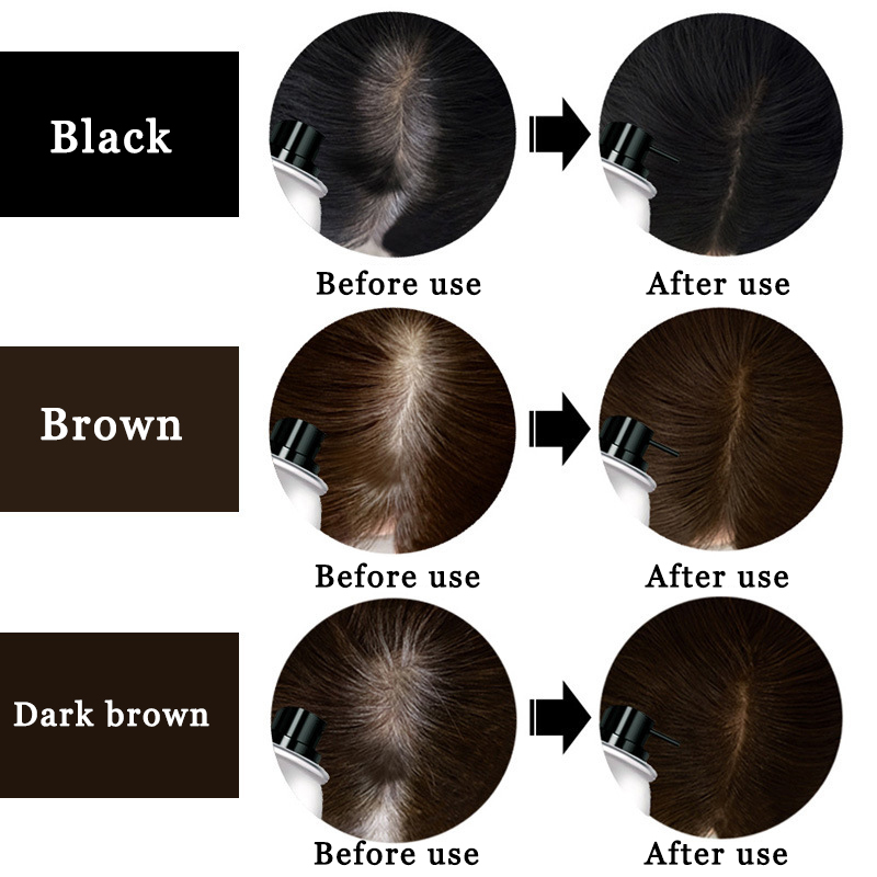 Hair Growth Spray
