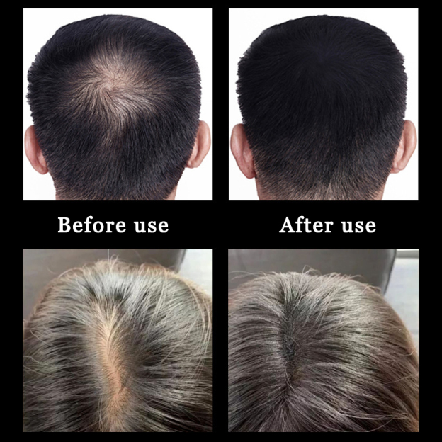 Hair Growth Spray