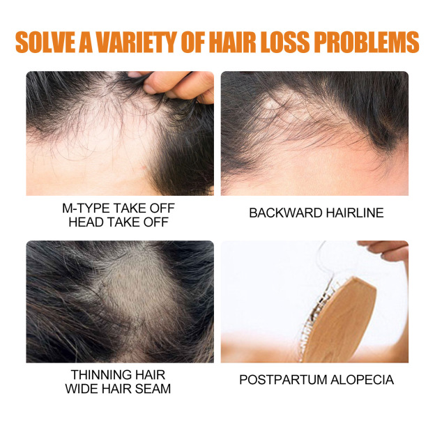 Hair Growth Spray