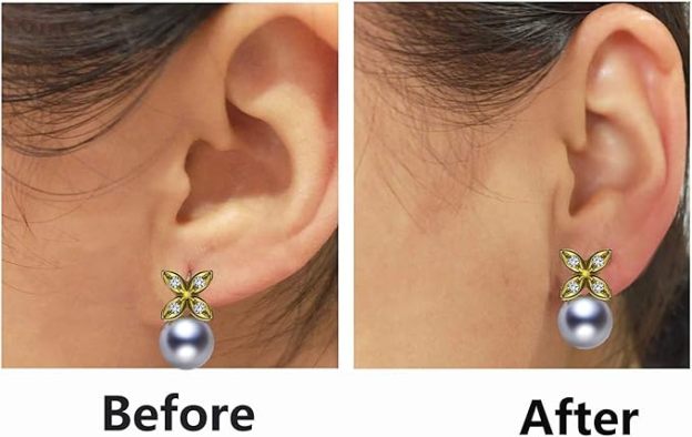 Ear stud auxiliary device to prevent drooping and falling off