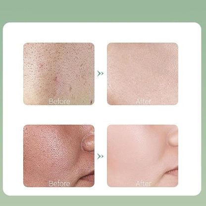 Centella Asiatica Bubble Mask