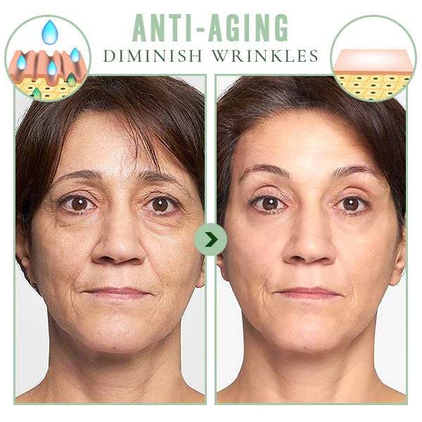 💖Early Mother's Day Sale - 48% OFF🌹KOREAN BEAUTY COLLAGEN FIRMING MA