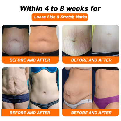 🔥Negative Ion Fat Burning Tummy Slimming Detox Shaping Pants [Last 20 Minutes, limited Time 80% OFF]