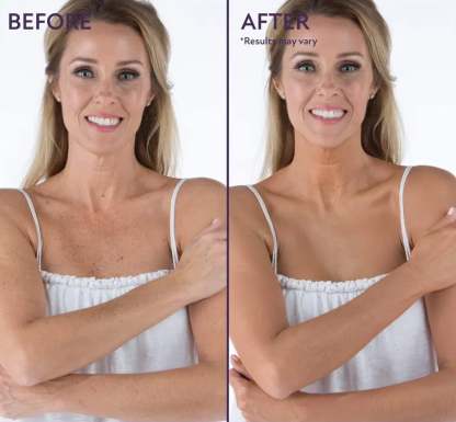 🏆Only $18.99Last Day Promotion! - All Over Complexion Perfector