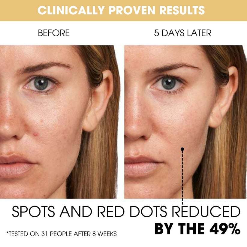 🔥Last Day 49% Off✨Deep Vita C Capsule Cream