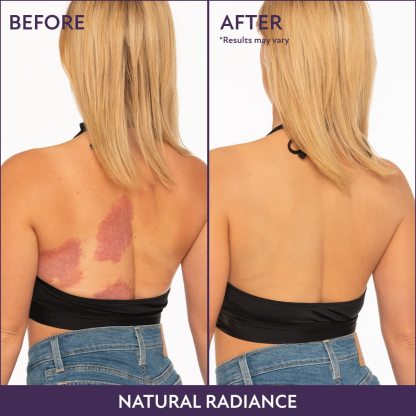 🏆Only $18.99Last Day Promotion! - All Over Complexion Perfector