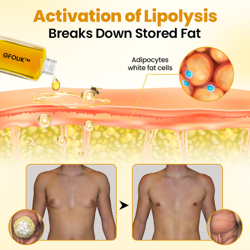 GFOUK™ ThermoFirm Bee Venom Gynecomastia-Oil