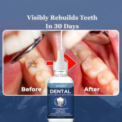 Nano-Hydroxyapatite Deep-Fusion Drops Advanced Enamel