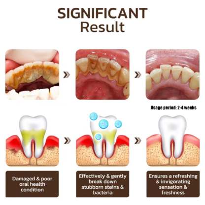 ✨ Achieve a Radiant Smile - 49% OFF - 🦷 Niacinamide Whitening Toothpaste - For Healthier, Whiter Teeth!