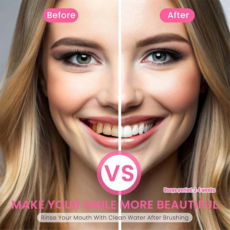 ✨ Achieve a Radiant Smile - 49% OFF - 🦷 Niacinamide Whitening Toothpaste - For Healthier, Whiter Teeth!