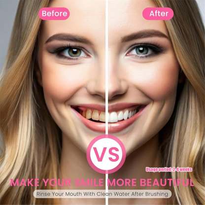 ✨ Achieve a Radiant Smile - 49% OFF - 🦷 Niacinamide Whitening Toothpaste - For Healthier, Whiter Teeth!