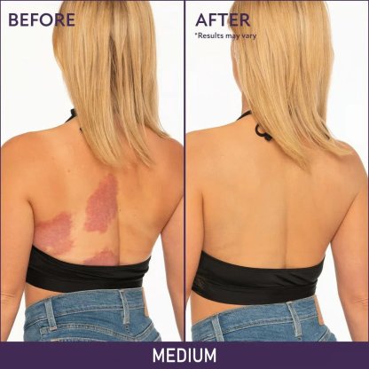 🎁LAST DAY BUY 1 GET 1 FREE!!🔥Soft Matte Cream Concealer