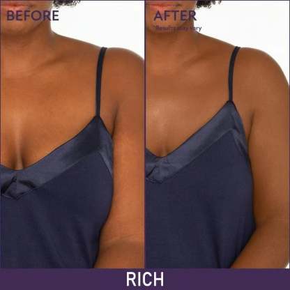 🎁LAST DAY BUY 1 GET 1 FREE!!🔥Soft Matte Cream Concealer