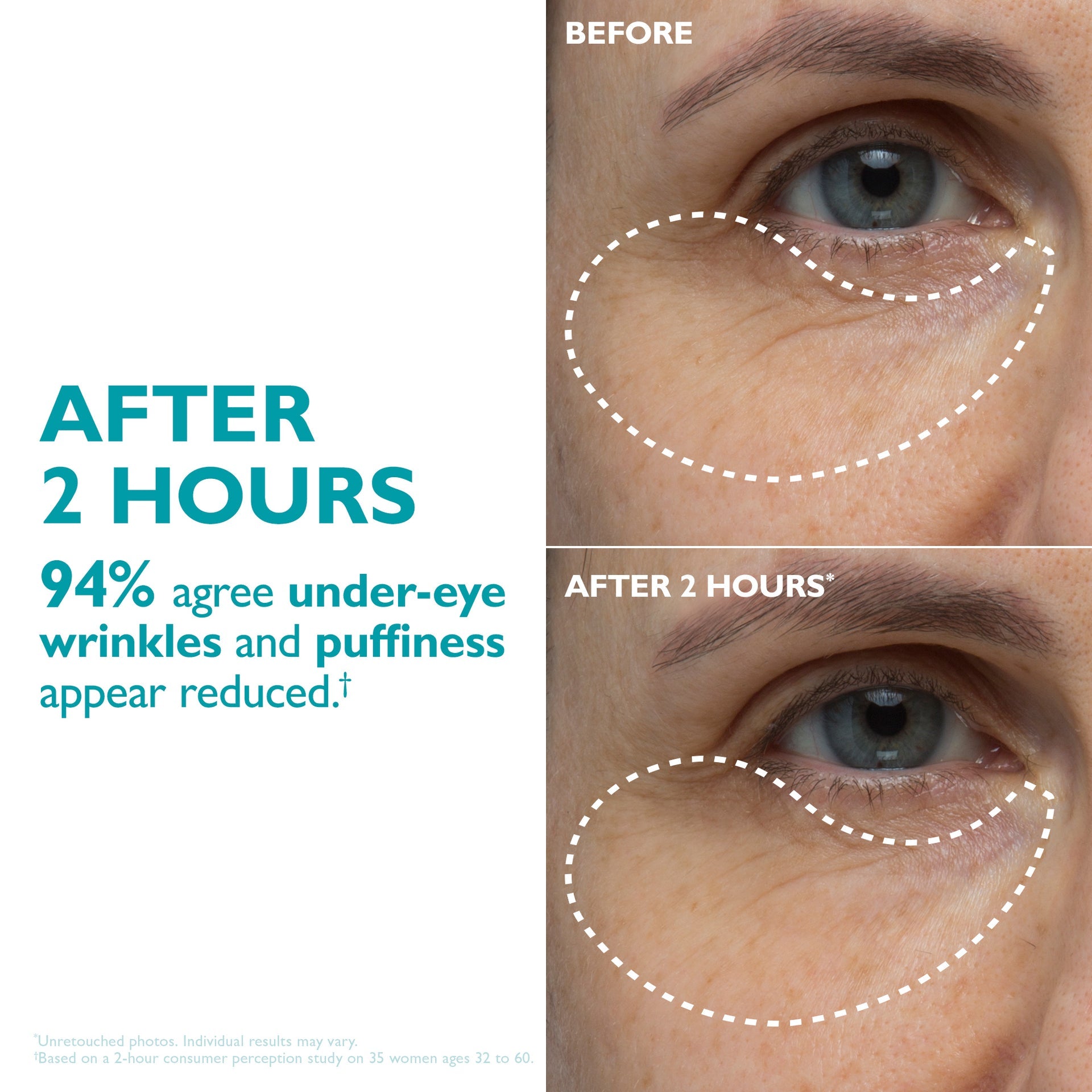 Peptide-Infused Face & Eye Tape