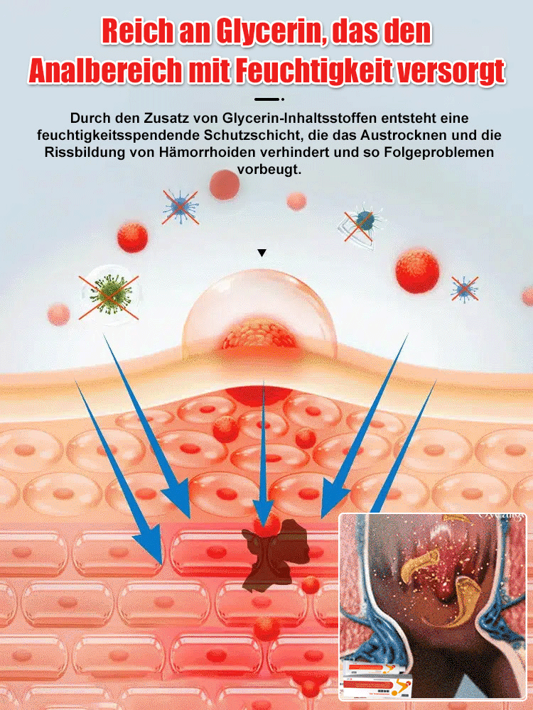 Gel für kalte Kompressen gegen Hämorrhoiden