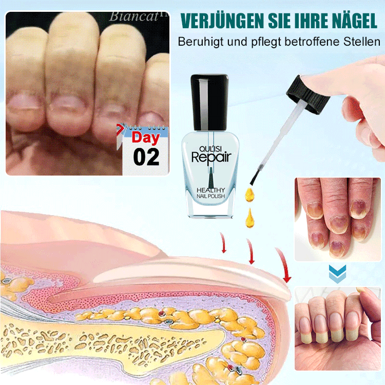 Nagelwachstum-Reparatur-Lotion