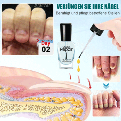 Nagelwachstum-Reparatur-Lotion