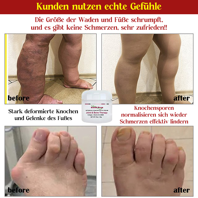 Kollagencreme für Knochengelenke