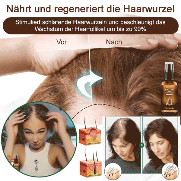 Biotin-Haarwachstumsspray