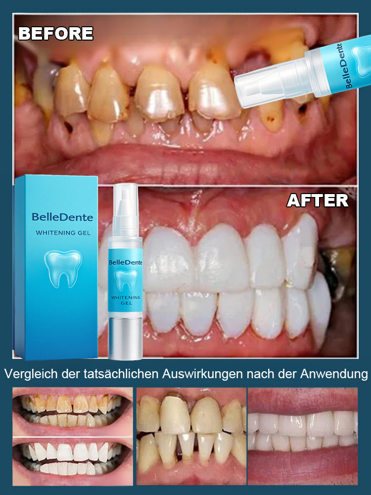 ✨Die ultimative Lösung für empfindliches Zahnfleisch: 🧴Zahnregenerierendes und reparierendes Gel! 🌿Formuliert mit natürlichen Pflanzenextrakten, 🩹repariert es zurückgehendes Zahnfleisch, 🛡️stärkt den Zahnschmelz und sorgt so für stärkere Zähne in nur 